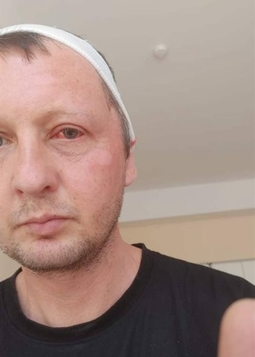 Після важкої травми голови та операцій: родина первомайця просить допомогти зі збором коштів