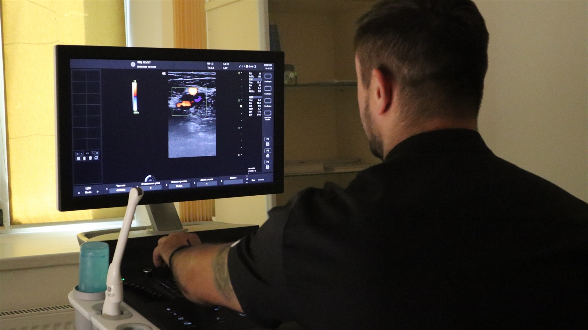 Обстеження, яке рекомендовано пройти кожному: лікар з медцентру «Агапіт» розповів про УЗДД судин