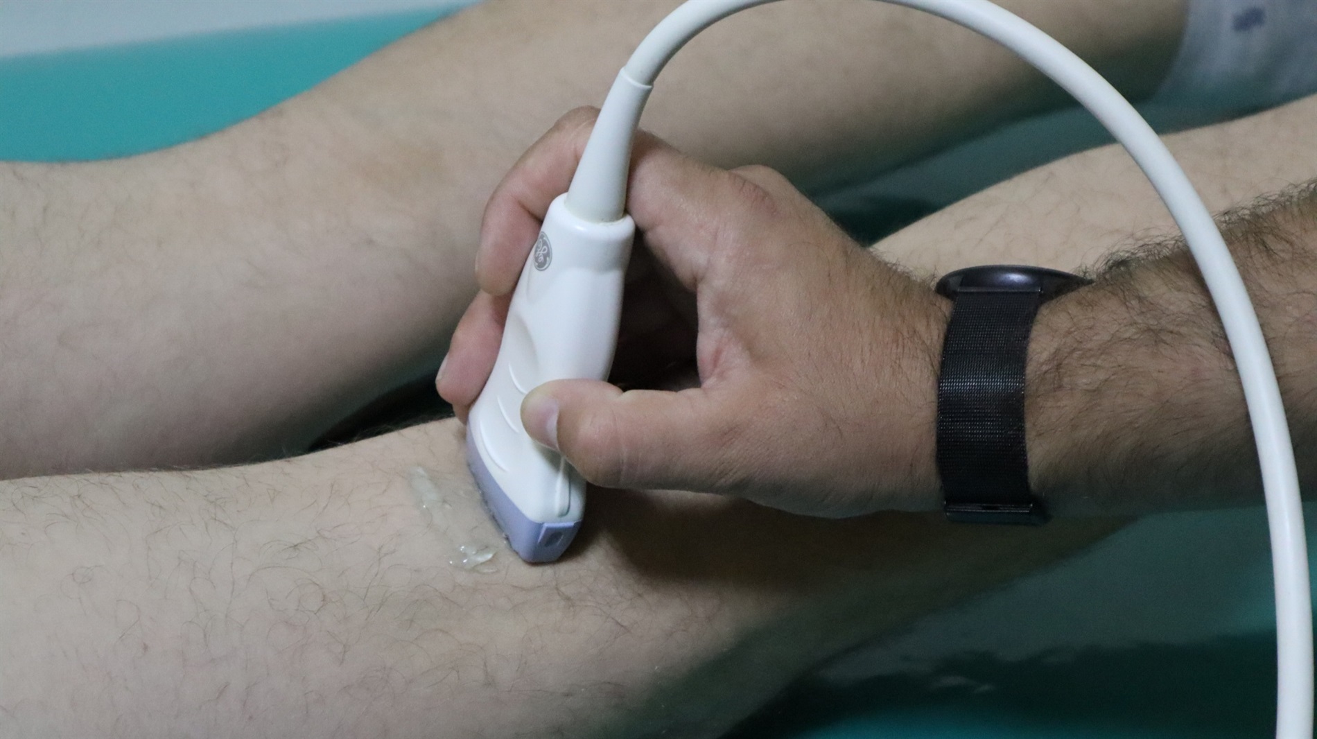 Обстеження, яке рекомендовано пройти кожному: лікар з медцентру «Агапіт» розповів про УЗДД судин