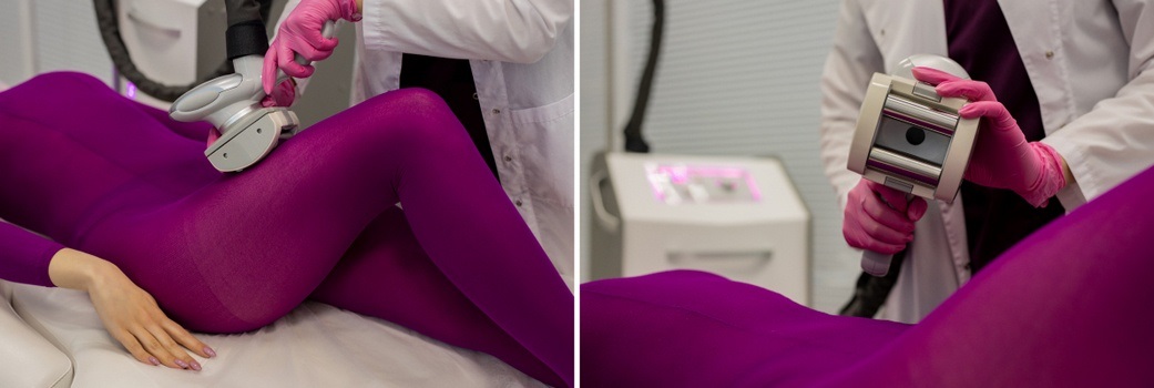 https://medicalaser.com.ua/